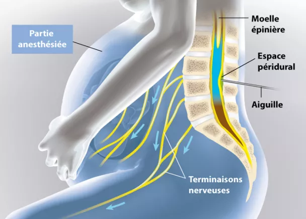 Que l'on opte pour un accouchement avec ou sans péridurale, il est trè