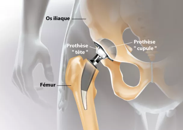 Anatomie de la hanche