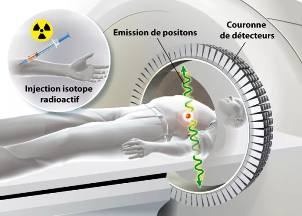 Scanner ou tomodensitométrie - Définition, intérêt, déroulement de