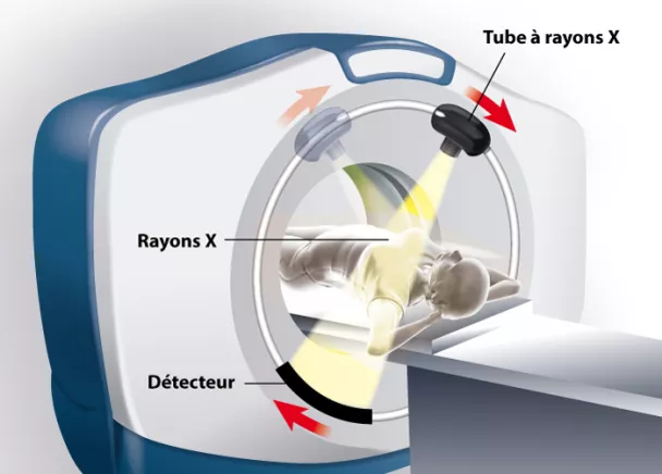 Le Scanner et sa contribution aux traitements de radiothérapie