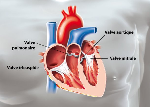 Valves Cardiaques | Ramsay Santé