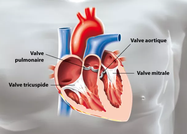 Les maladies des valves cardiaques ou les valvulophaties - HUG