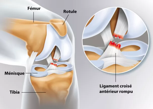 tendon du genou